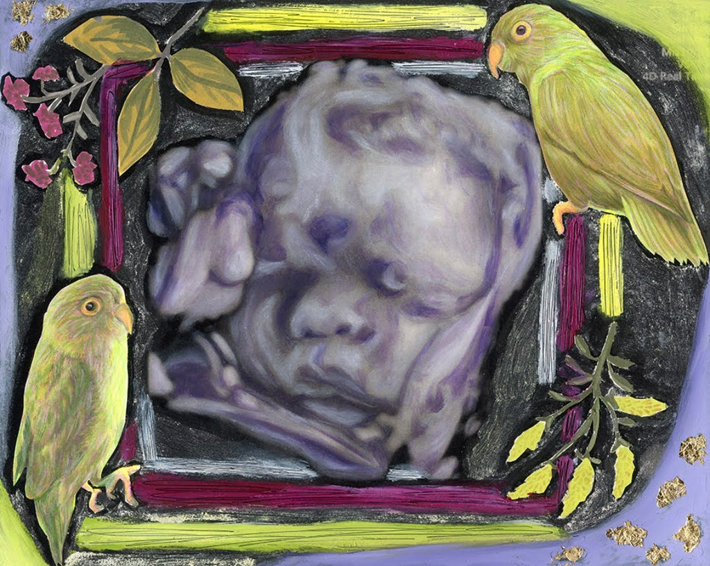 Mixed-Media Ultrasound Painting on 8" x 10" Wooden Canvas